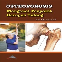 Image of Osteoporosis Mengenal Penyakit Keropos Tulang